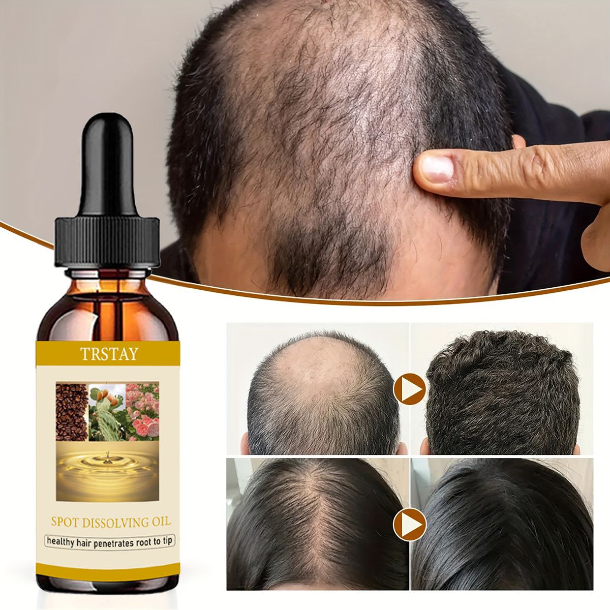 50ML Beard Growth Oil Anti Alo - Beard Oil บทวิจารณ์และราคา