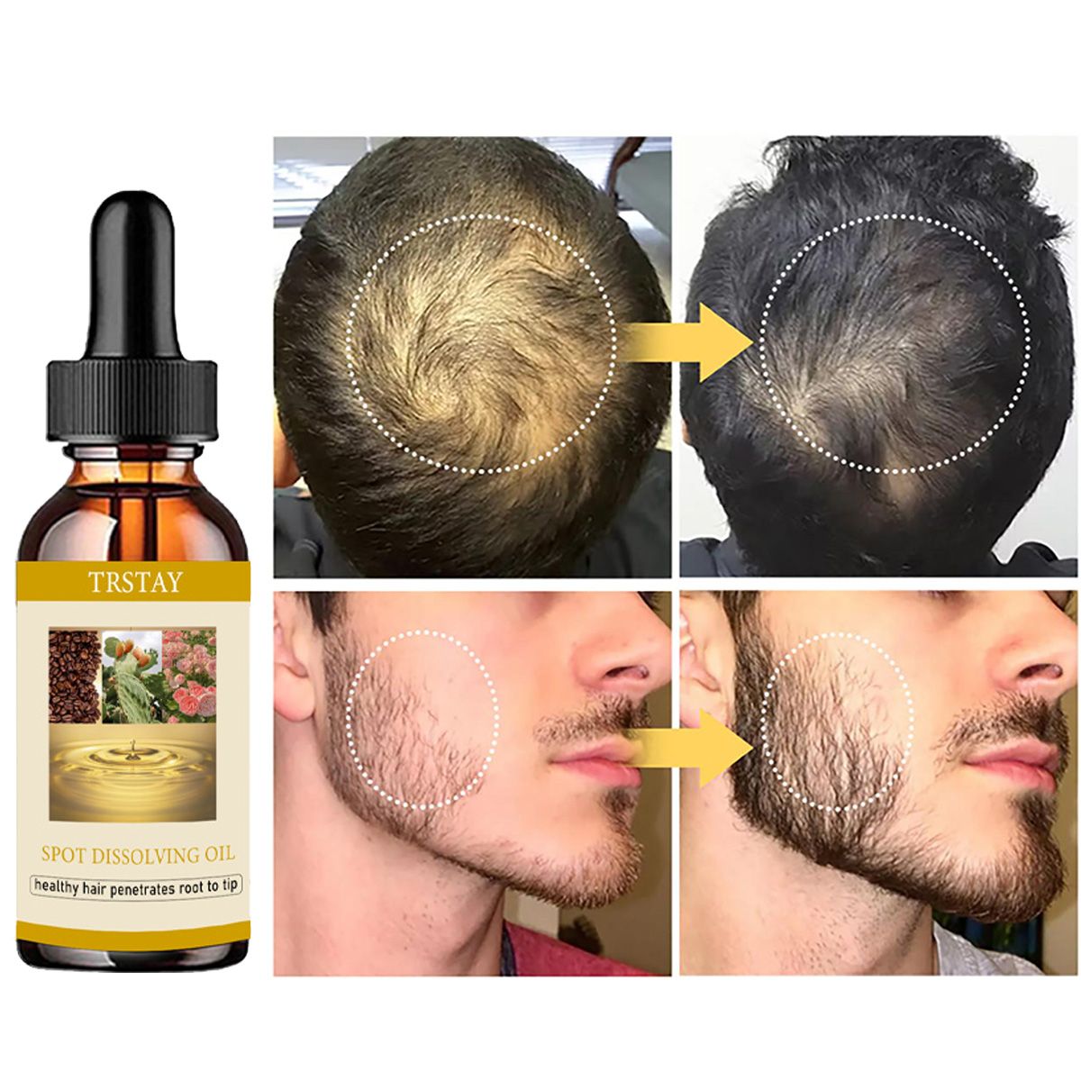 50ML Beard Growth Oil Anti Alo - Beard Oil บทวิจารณ์และราคา