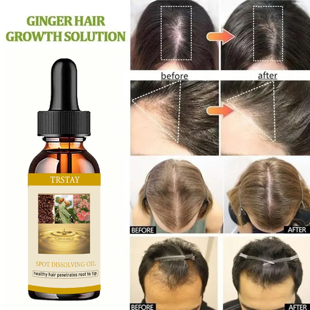 50ML Beard Growth Oil Anti Alo - Beard Oil บทวิจารณ์และราคา